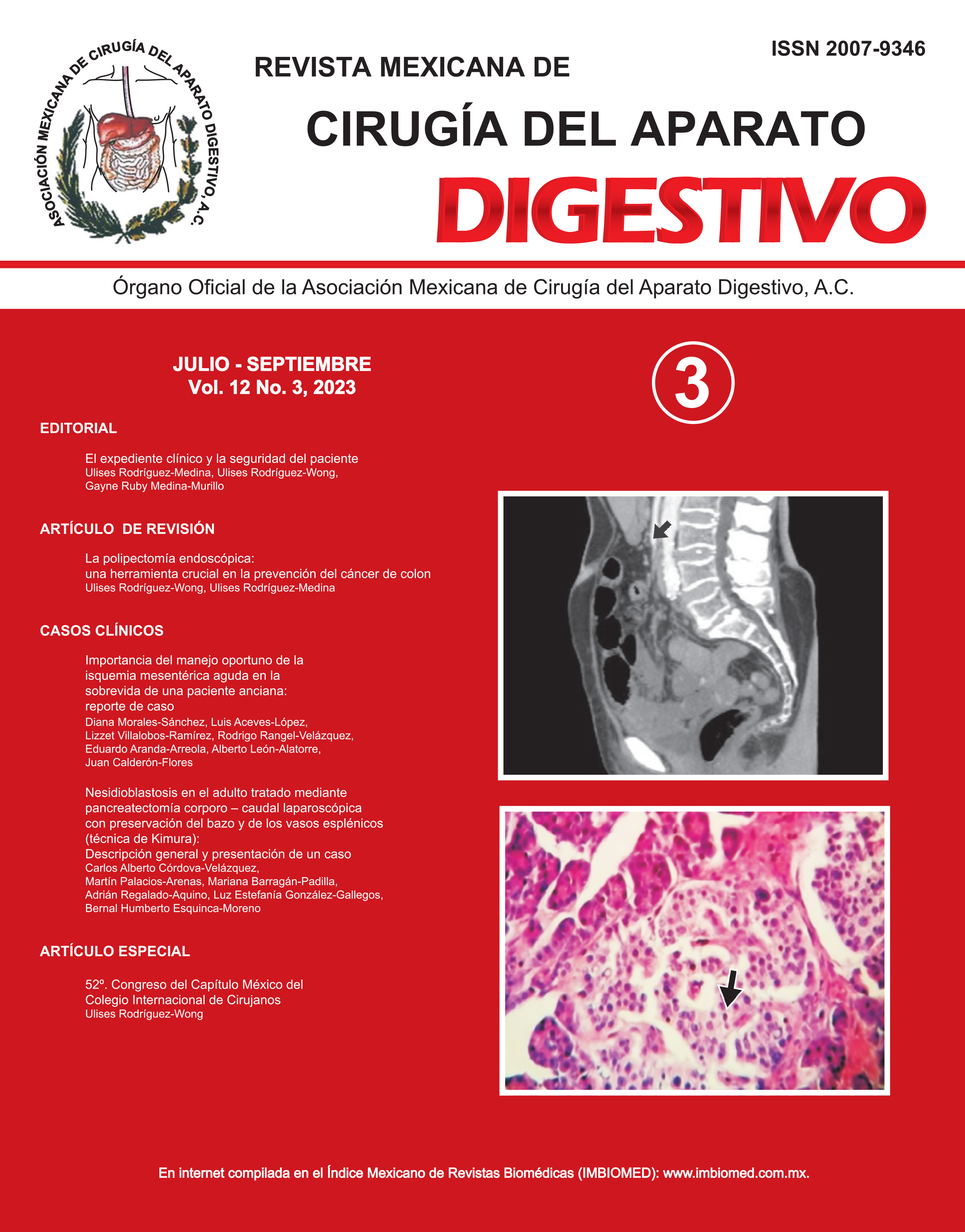 Revista Mexicana de Cirugía del Aparato Digestivo